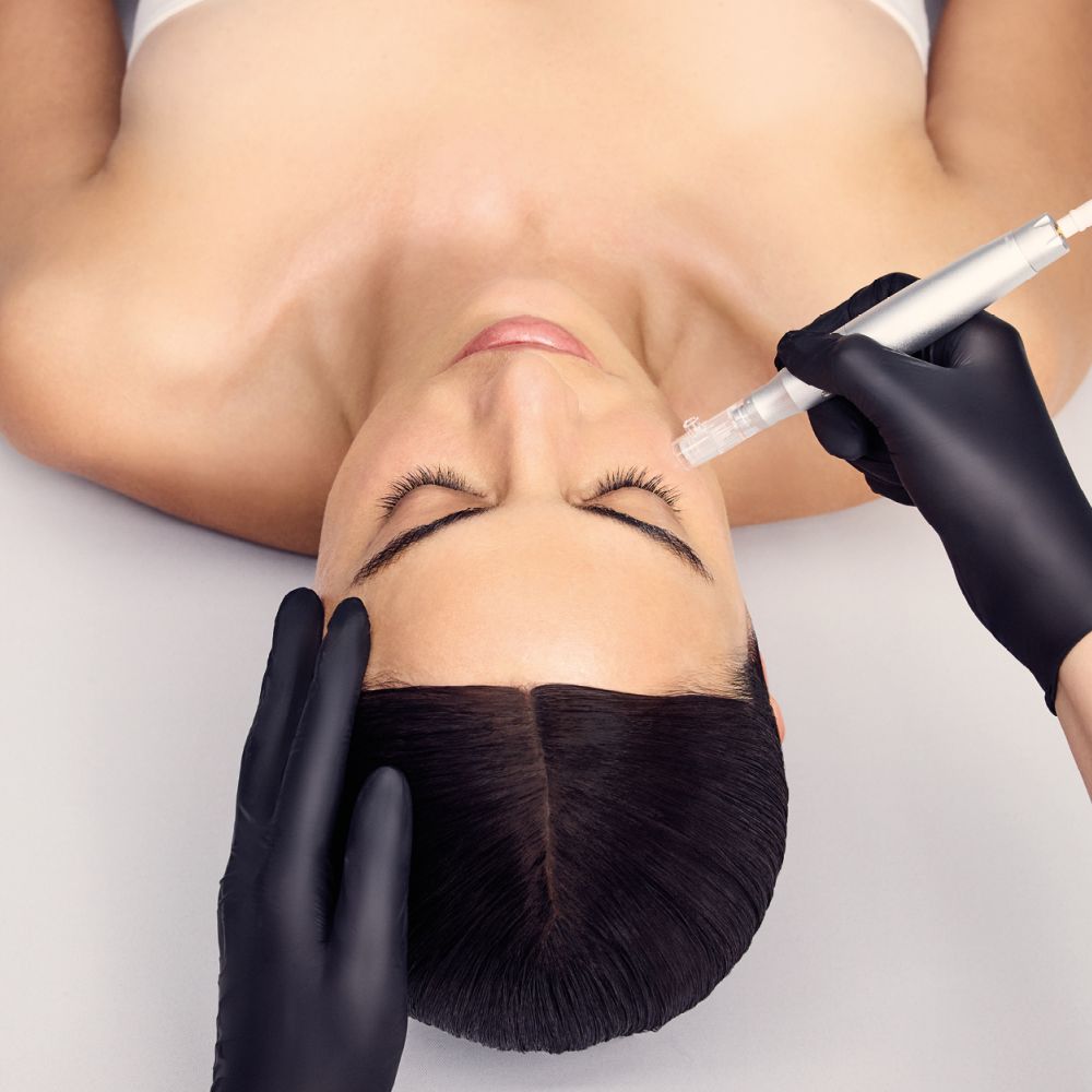 Microneedling Behandlung mit DOCTOR BABOR PRO im Kosmetikstudio